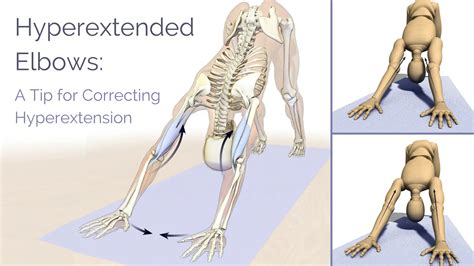 Hyperextension Arm