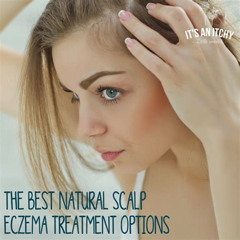 The Best Natural Scalp Eczema Treatment | It's an Itchy Little World