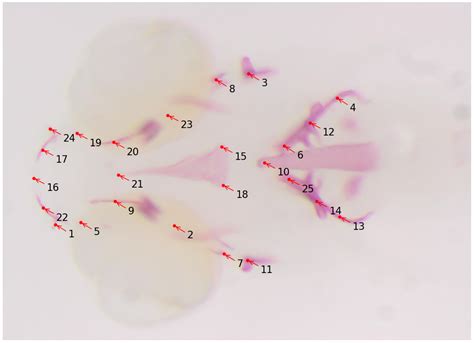 Recent Advances in Bioimage Analysis Methods for Detecting Skeletal ...