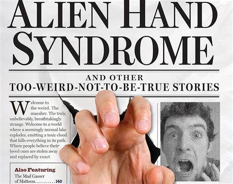 Image result for Alien Hand Syndrome Real