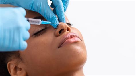 Healing Time of Rhinoplasty – How to Reduce Swelling After a Nose Job - Dr. Cengizhan Ekizceli