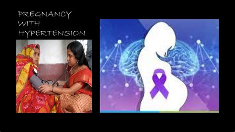 Safe Pregnancy