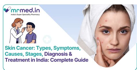 Skin Cancer: Causes, Types, Signs, Symptoms & Treatment Guide
