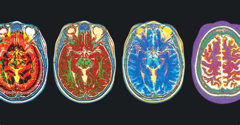 Brain Science.com 的图像结果