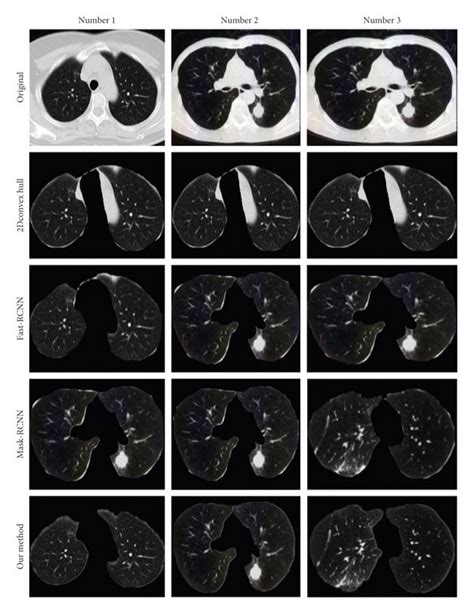 LPS Algorithm 的图像结果