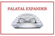 E-MAX || Smile Stones Dental Pvt Ltd