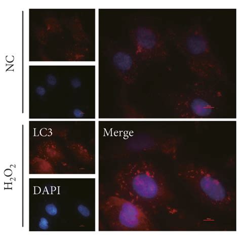 H2O2 Apoptosis 的图像结果