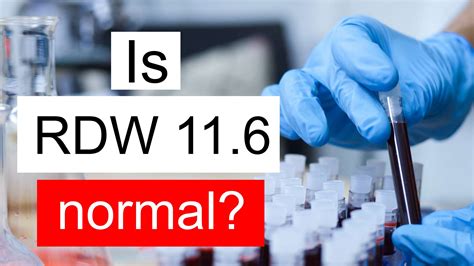Is RDW 11.6 normal, high or low? What does Red cell distribution width level 11.6 mean?