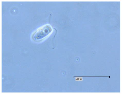 Free-Living Amoebae as Human Parasites and Hosts for Pathogenic ...