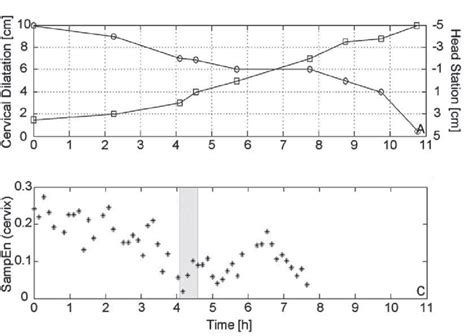 Image result for Partogram Examples