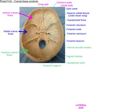 Cranial Fossa