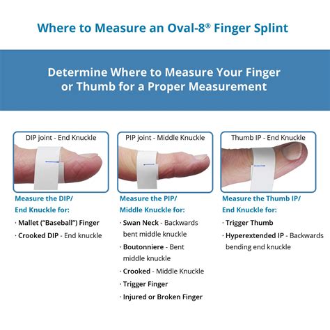 Oval-8 Finger Splints | Trigger thumb, Joints pain remedy, Trigger finger