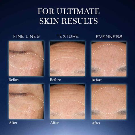 Genifique Ultimate Skin Repair Serum With Beta Glucan (Suited for ...