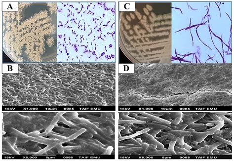 Synergistic Antibacterial and Antibiofilm Effects of Clindamycin and ...