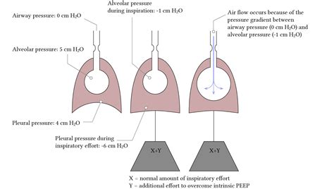 Intrinsic PEEP and positive pressure ventilation | Deranged Physiology