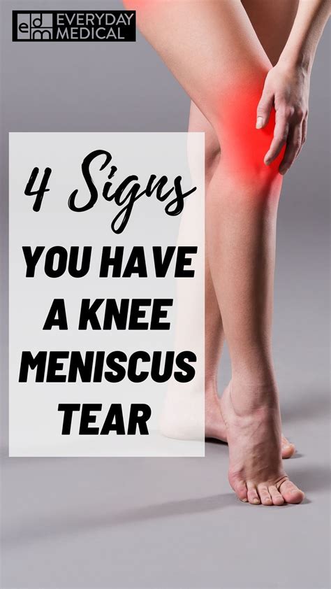 Meniscus tear symptoms and recovery – Artofit
