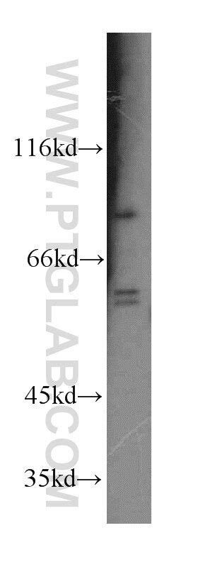 RRM1 antibody (19686-1-AP) | Proteintech