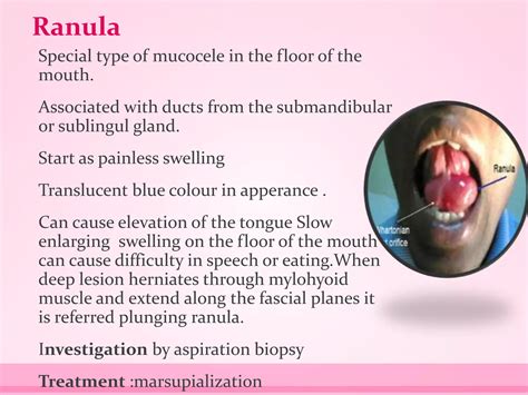 Salivary gland diseases | PPTX | Ear, Nose and Throat Conditions | Diseases and Conditions