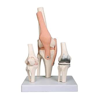 Kay Kay Industries Premium Knee Joint Model Anatomy Set | Life Size ...