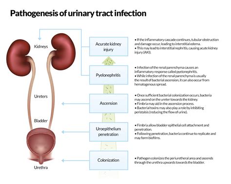 UTI Uncomplicated: Acute Simple Cystitis | Nursing CEU | CEUfast