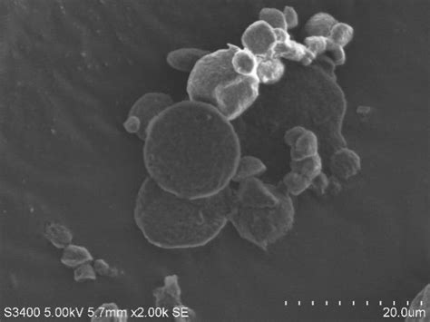 Fig. 11B: SEM image of HA RTN (Magnification X 10,000)
