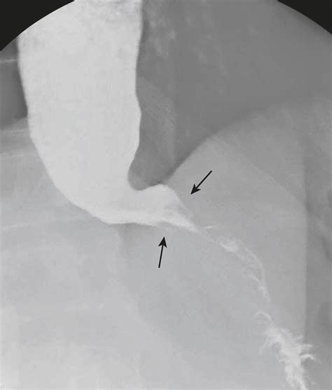 Diagnostic Radiology Signs - Clinical Tree
