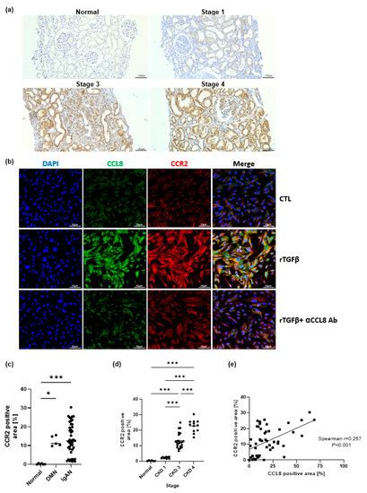 Cells | Special Issue : Developmental Origins of Kidney Disease and ...