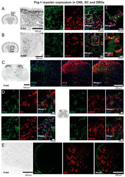 Lysophosphatidic Acid Receptors LPAR5 and LPAR2 Inversely Control ...