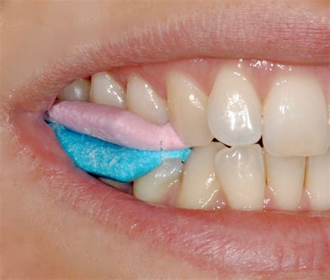 Biting Inside of Lip Causes, While Eating, Anxious, on Bottom Lip, How to Stop and Heal Sore ...