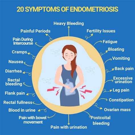 20 Symptoms Of Endometriosis