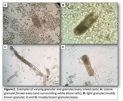 Mixed Urogenital Flora In Urine Means at Roxanne Bell blog