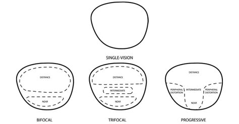 bifocal lenses or progressive lenses?
