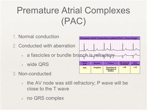 ECG Interpretation Criteria Review - ppt video online download