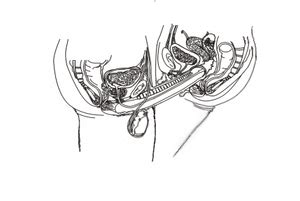 Image result for Alien Inlay Idea