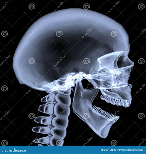 X-ray of the Human Skull. Side View Stock Illustration - Illustration ...