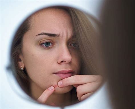 Meaning Of Pimples On Different Parts Of The Face | Herzindagi