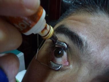 Subconjunctival Injection 的图像结果