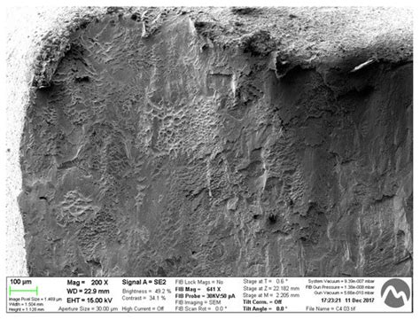 Influence of the CAD-CAM Systems on the Marginal Accuracy and ...