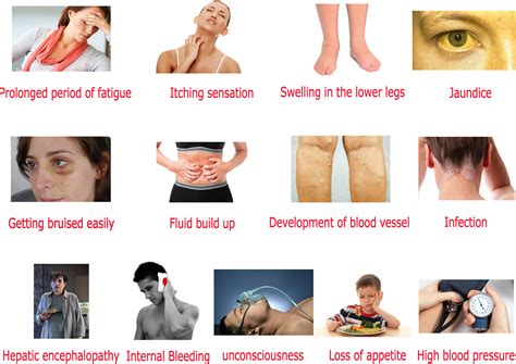 liver symptoms women over 50 – liver pain symptoms – VBSAL