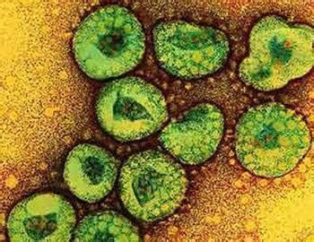 预防新型冠状病毒感染 日常要做好4个防护措施
