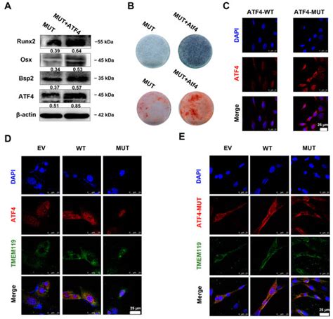TMEM119 (c.G143A, p.S48L) Mutation Is Involved in Primary Failure of ...