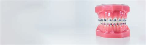 Best Dental Braces Treatment | Best Dental Braces Specialist