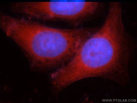 IDH1 antibody (12332-1-AP) | Proteintech