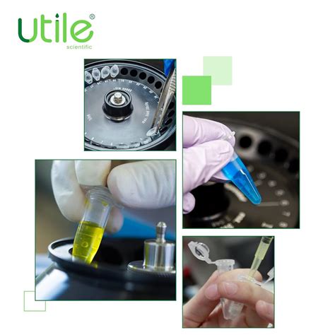 Utile 500pcs of 1.5ml Microcentrifuge Tubes, PP India | Ubuy