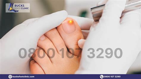 Sore Toenail When Pressed