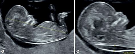 Fetal Medicine - Clinical Tree