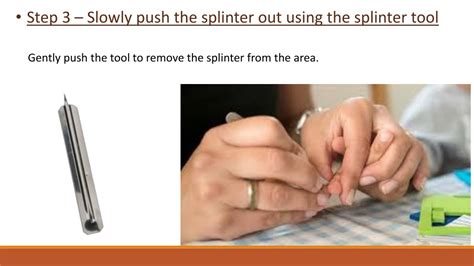 Image result for Getting Splinter Out