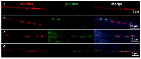 Expression of Two Rye CENH3 Variants and Their Loading into Centromeres