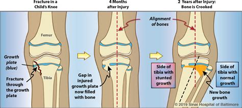 Image result for Appendix with Screen Shot Example