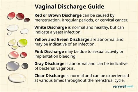 Yellow Vaginal Discharge: What Does It Mean?